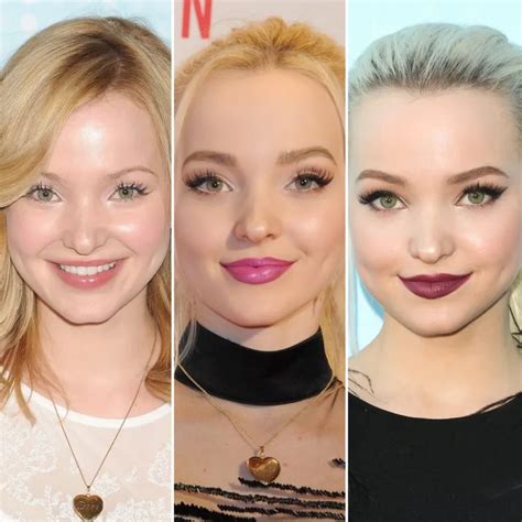 dove cameron before surgery|Dove Cameron — Plastic Surgery, Photoshop And Evolution.